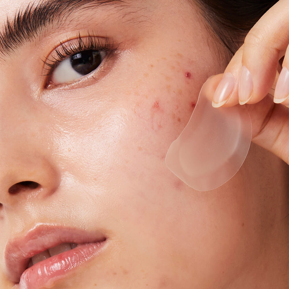 timeout blemish patch chin and cheeks - tea tree leaf acne patch - invisible acne patch for chin and cheeks